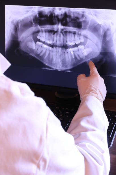 Best Emergency Gum Treatment in Santa Maria, CA
