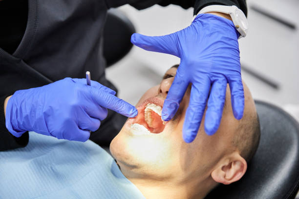 Best Emergency TMJ Treatment in Santa Maria, CA
