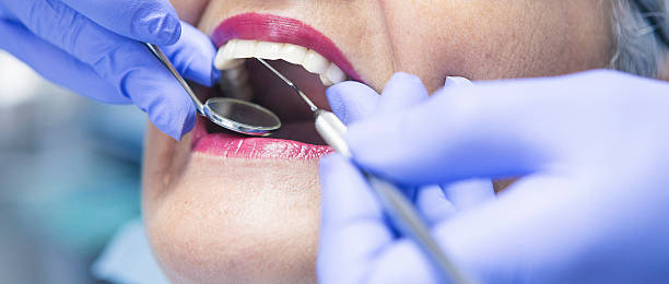 Best Urgent Care for Lost Fillings or Crowns in Santa Maria, CA
